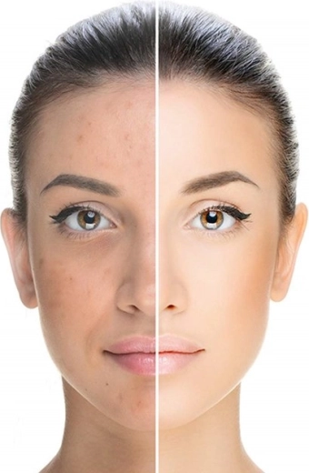 Care for the appearance of the skin